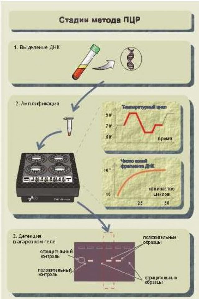 Що таке ПЛР аналіз - метод діагностики, як здавати на дослідження