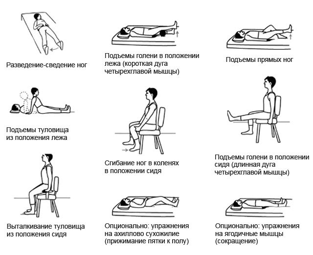 Реабілітація після ендопротезування кульшового суглоба: етапи, прогноз