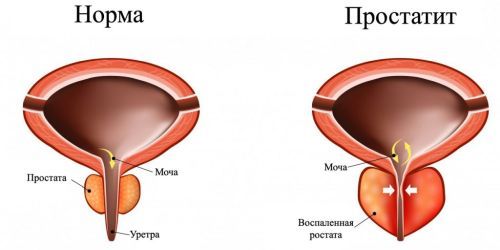 Норма сечовипускання в день у чоловіків дорослих: частота і кількість