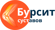 Препателлярний бурсит (колінного суглоба): суть патології, причини, лікування