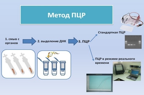 Мазок з уретри у чоловіків: як беруть на інфекції, на флору і ПЛР аналіз