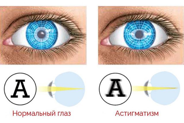 Зір у людини: що це значить, визначення гостроти зору, яке буває