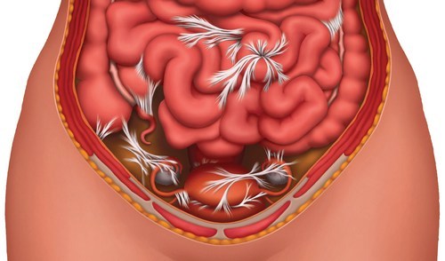 Від чого виникають різні патології кишечника?