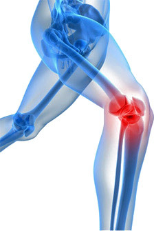 Пункція колінного суглоба: показання, техніка виконання, точки проколів, наслідки