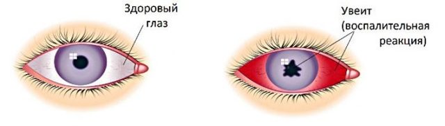 Очні краплі Дексон: інструкція із застосування для очей, склад, аналоги