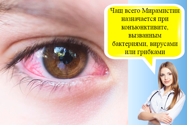 Мірамістин для очей: чи можна промивати, як капати при кон'юнктивіті, інструкція із застосування