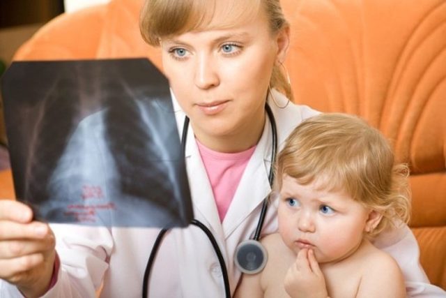 Правобічна пневмонія у дітей: причини, ознаки і лікування