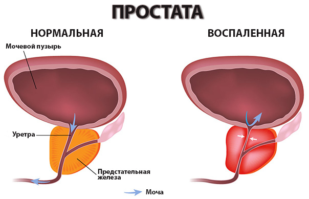 Норма сечовипускання в день у чоловіків дорослих: частота і кількість