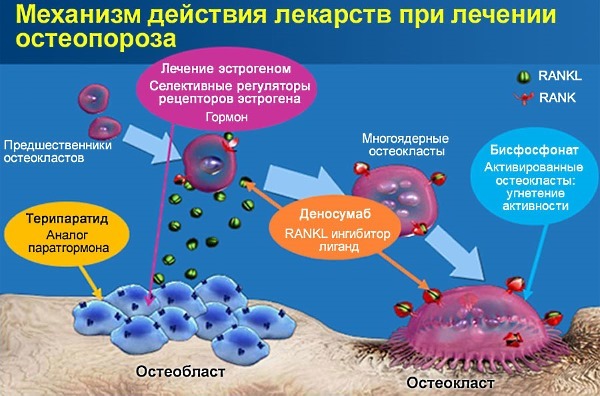 Бісфосфонати для лікування остеопорозу: ефективність, показання, назви препаратів