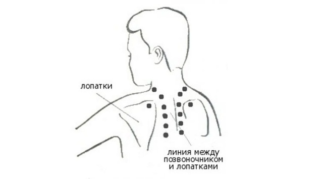 Масаж при остеохондрозі шийного відділу хребта: техніка, показання