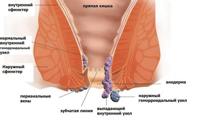 Тенезми кишечника: причини і лікування патології