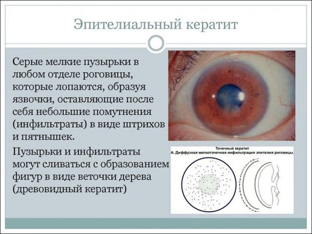 Очні краплі Дексон: інструкція із застосування для очей, склад, аналоги