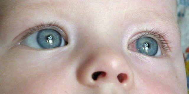 Очні краплі Окомістин: інструкція із застосування для дітей, відгуки, аналоги