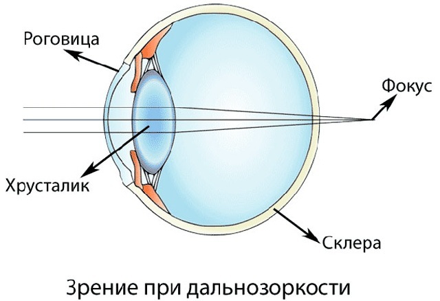 Зір у людини: що це значить, визначення гостроти зору, яке буває