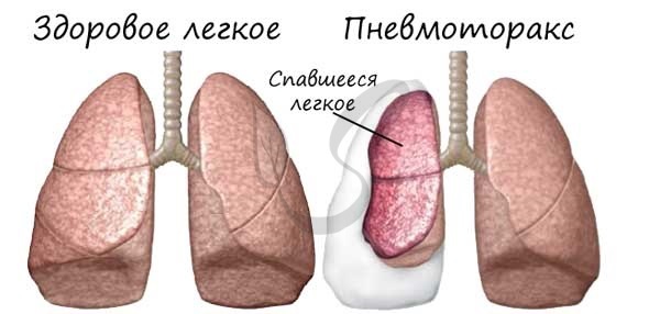 Анатомія і функція легенів