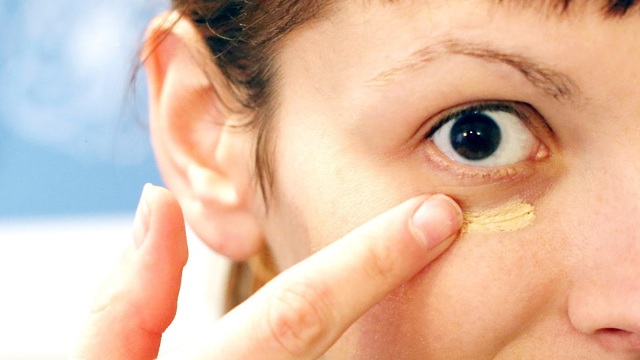 Жовті кола під очима: причини і лікування жовтизни у жінок і чоловіків