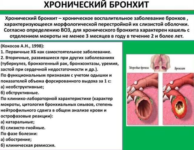 Профілактика бронхіту - як не захворіти