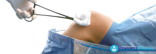 Реабілітація після артроскопії колінного суглоба: три фази відновлення