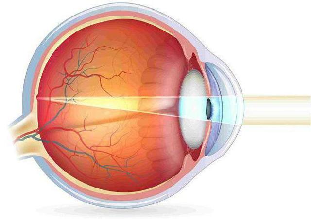 Акомодація ока: її порушення, обсяг, що собою являє, лікування