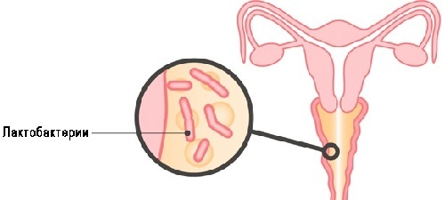 Вагіноз бактеріальний: лікування та причини виникнення
