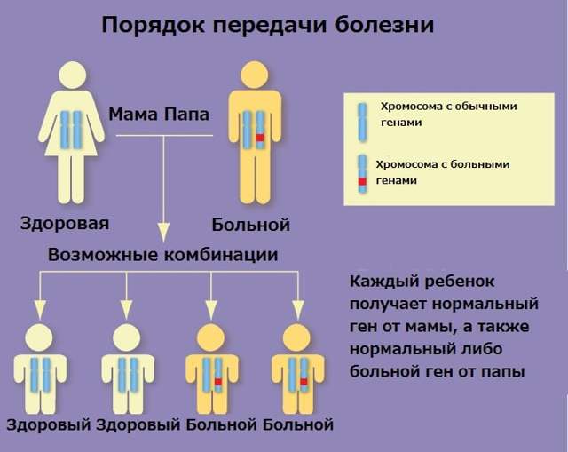 Хореї Гентингтона: що це за хвороба, причини, симптоми і лікування