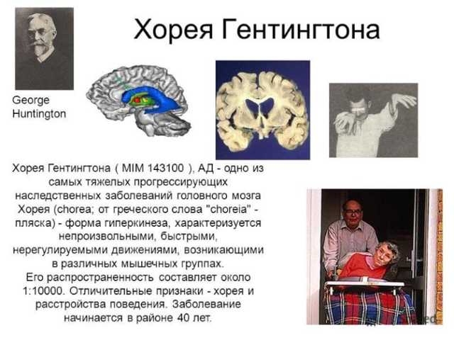 Хореї Гентингтона: що це за хвороба, причини, симптоми і лікування