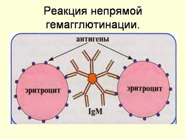 Що таке ПЛР аналіз - метод діагностики, як здавати на дослідження